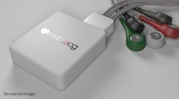MobilECG is an USB-based open source 12-lead clinical electrocardiograph. It is designed to meet all the relevant medical standards. Smaller than most ECGs and also has superior signal quality.